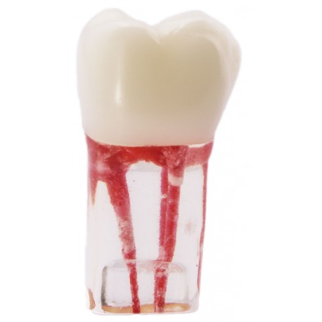 MOLAR CON CONDUCTOS RADICULARES