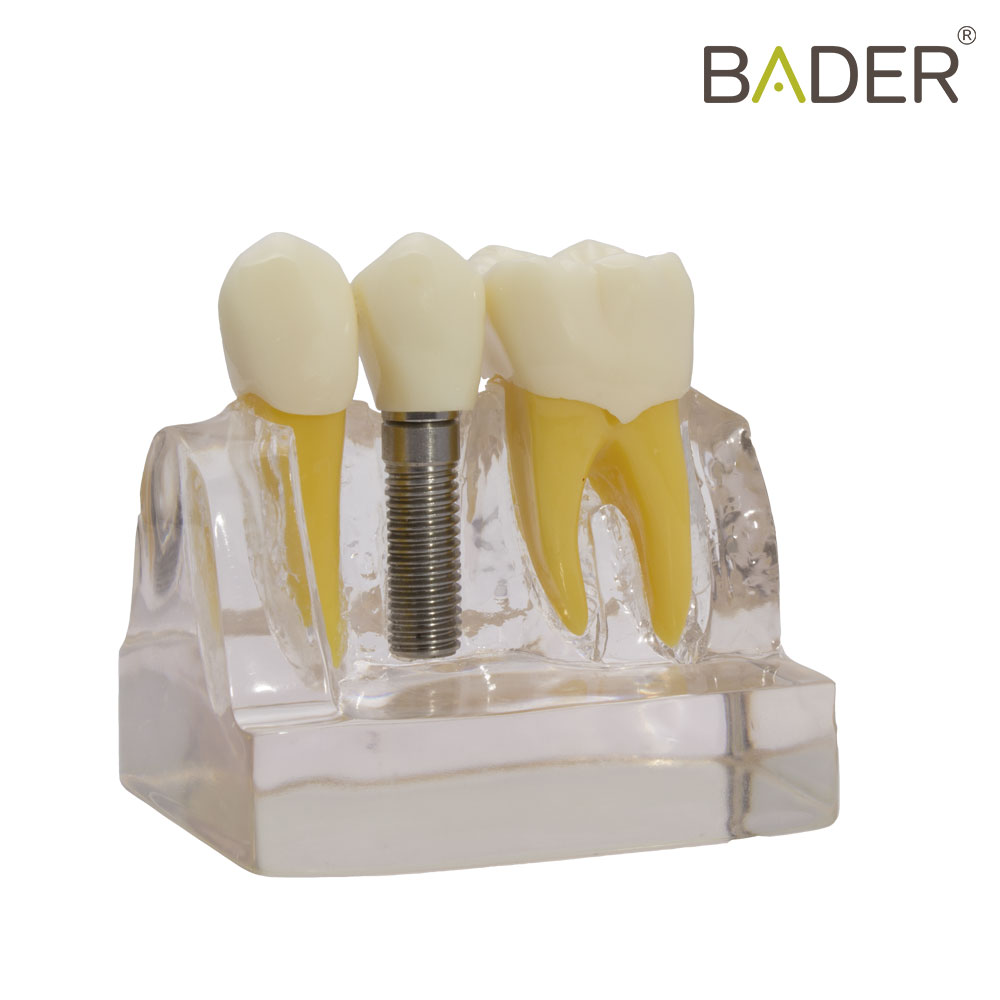 MODELO DE DEMOSTRACIÓN DE IMPLANTES