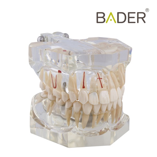 [0905123] MACROMODELO CON PATOLOGÍA COMPLETA